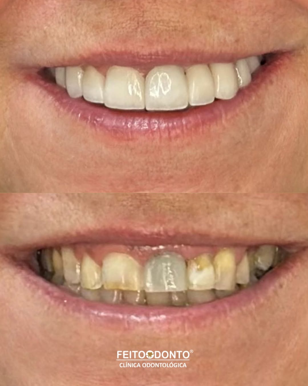 Um sorriso pode mudar tudo. A história dessa paciente é a prova viva disso.