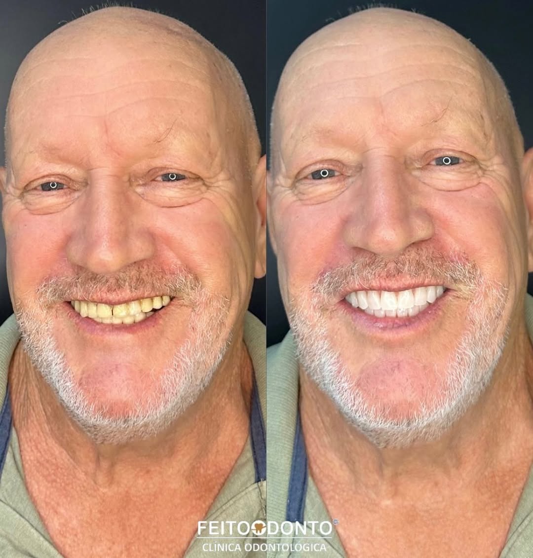 Um novo sorriso tem o poder de transformar a sua vida!