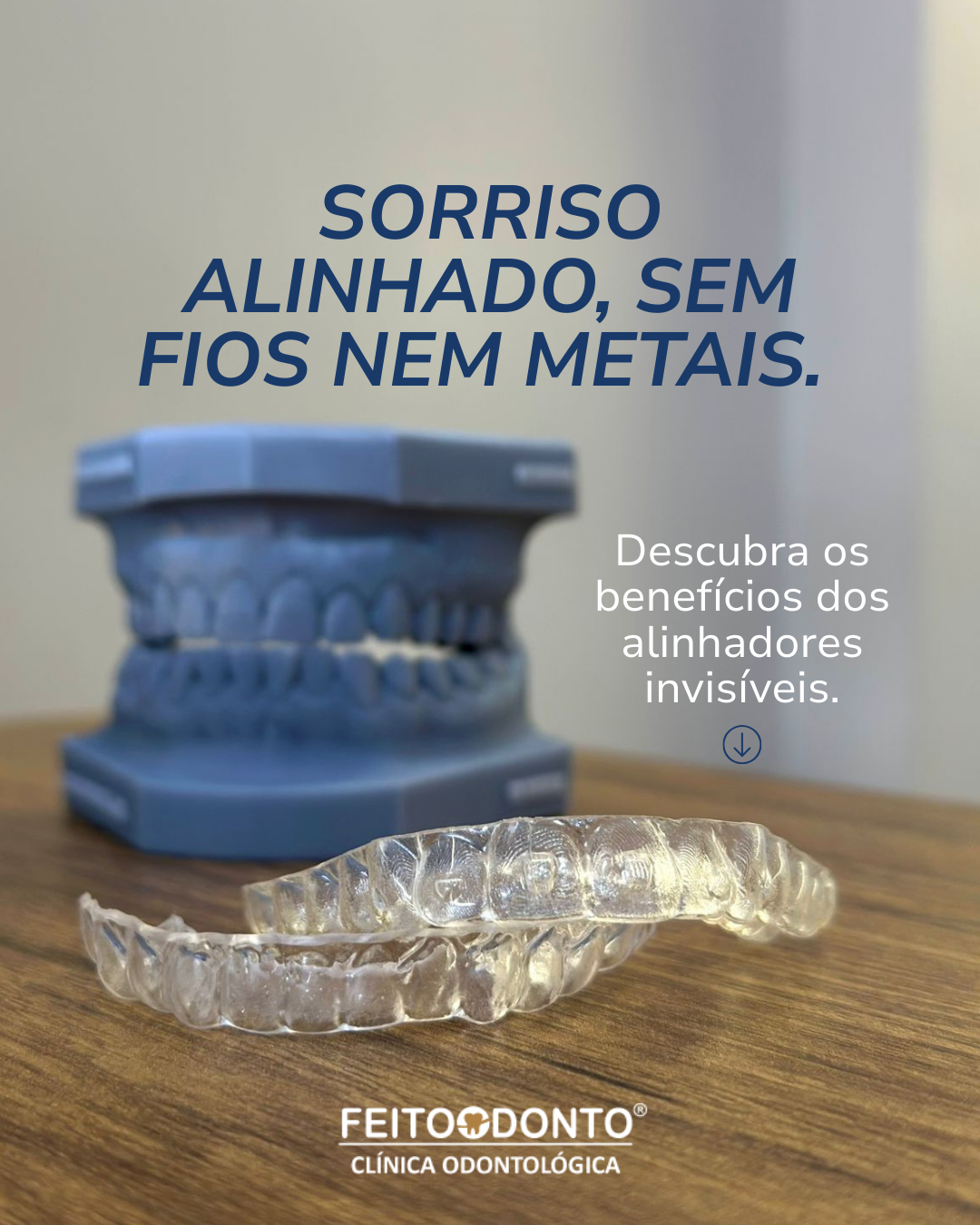 Alinhadores Invisíveis: A Evolução do Sorriso na Feitoodonto