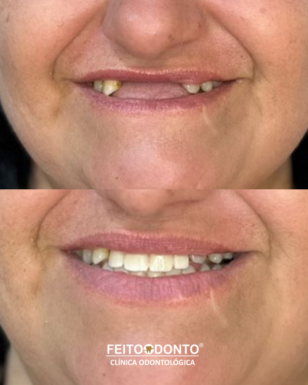 Quando o sorriso muda, a forma de se ver também muda