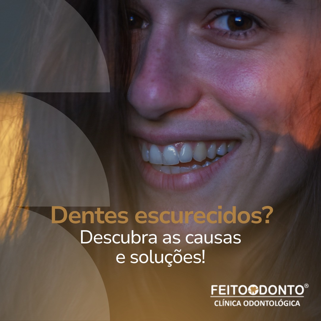 Dentes escurecidos? Descubra as causas e soluções!