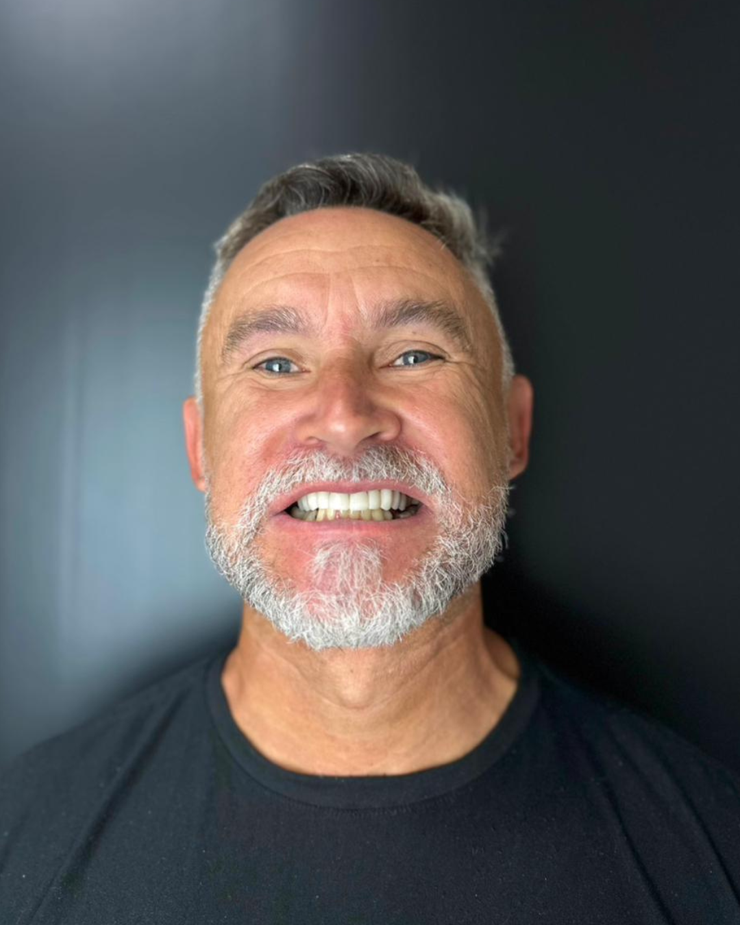 O sorriso do Carlos ganhou novos detalhes — mas sem perder quem ele é. 