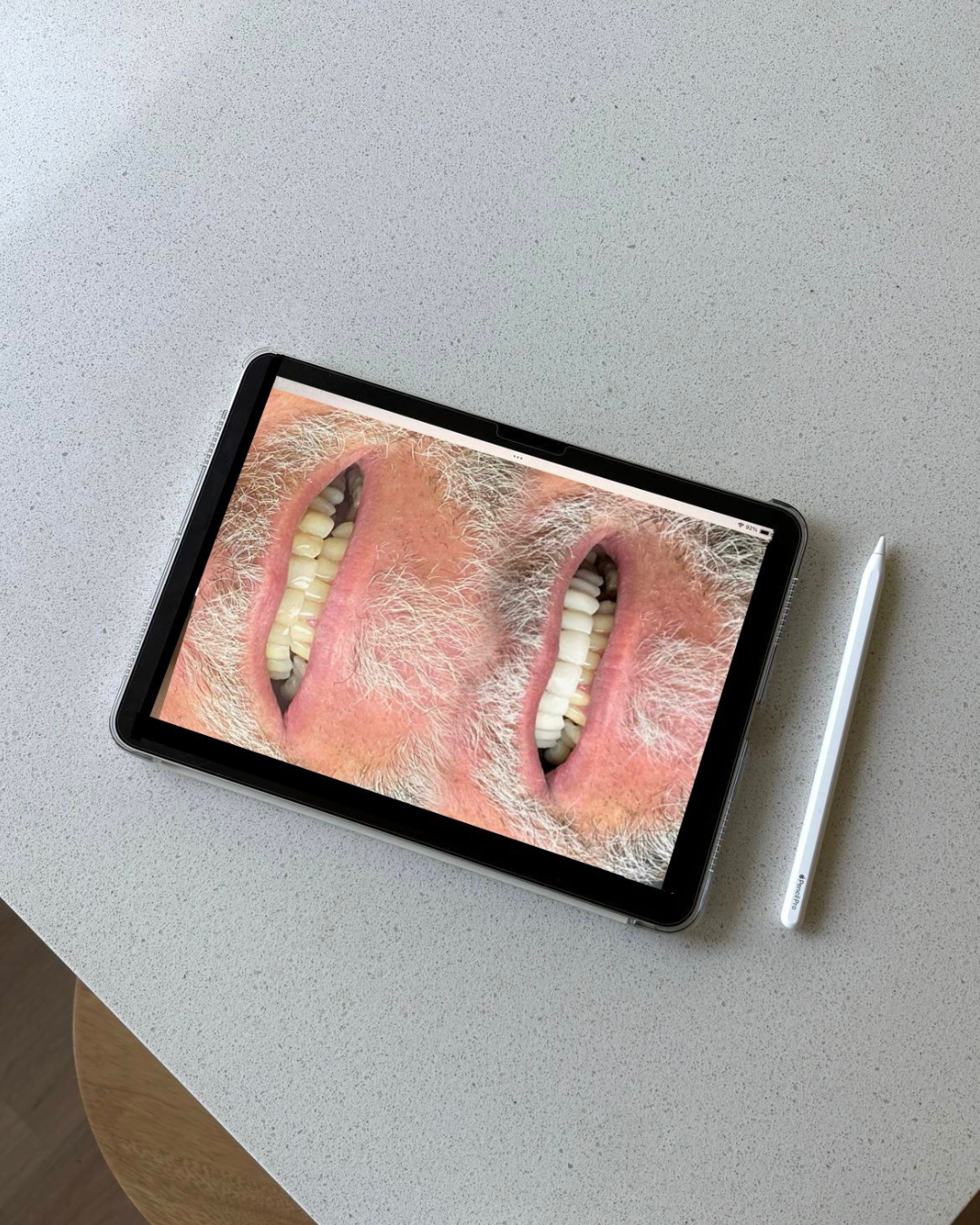 Pequenos ajustes podem fazer uma grande diferença no sorriso.